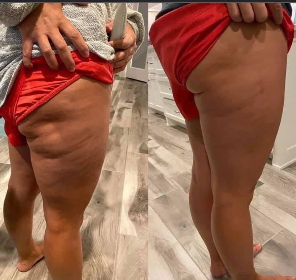 NuSkin Hibiscus and Honey Firming/Cellulite Remover Lotion