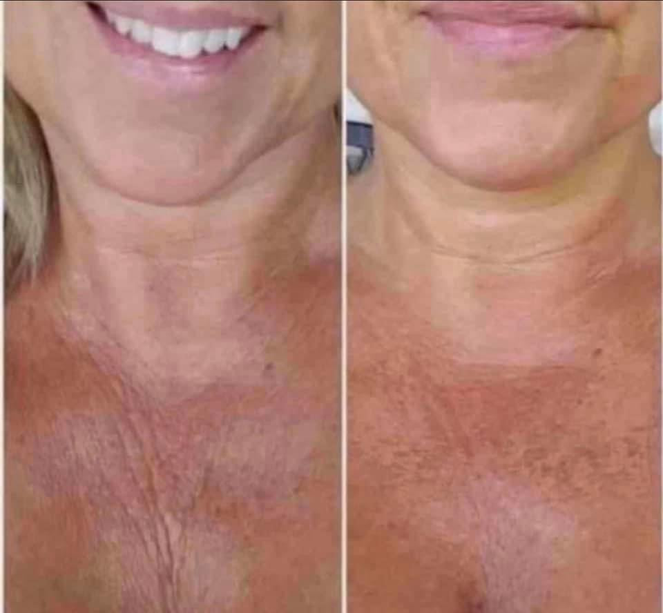 NuSkin Hibiscus and Honey Firming/Cellulite Remover Lotion