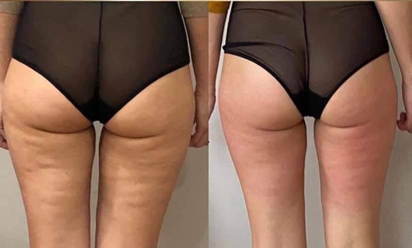 NuSkin Hibiscus and Honey Firming/Cellulite Remover Lotion
