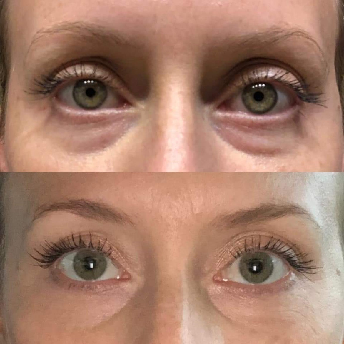 Eye Love Bright Eyes Cream