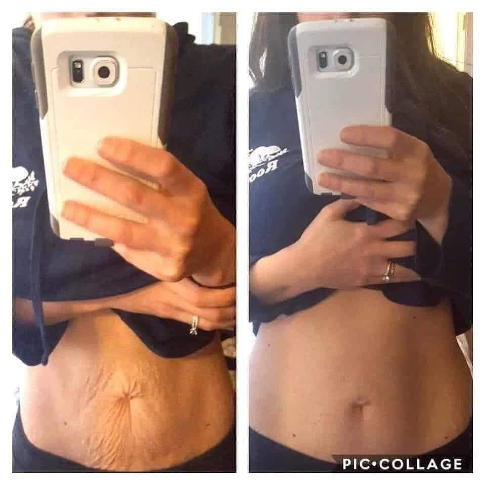 NuSkin Hibiscus and Honey Firming/Cellulite Remover Lotion