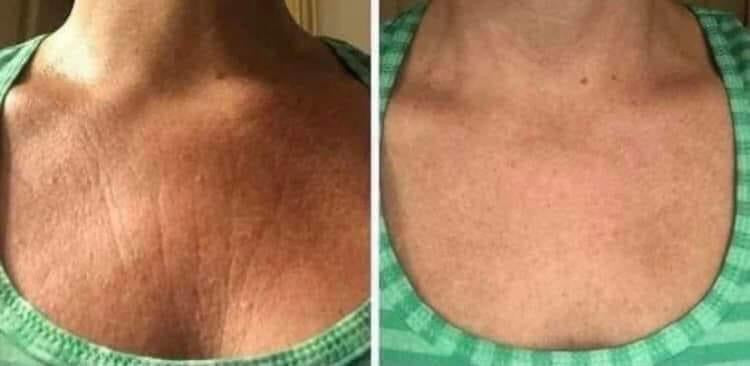 NuSkin Hibiscus and Honey Firming/Cellulite Remover Lotion
