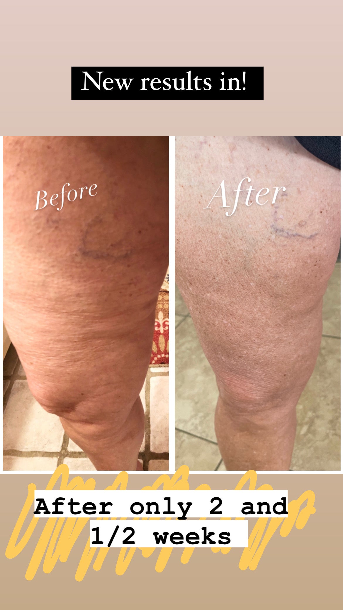 NuSkin Hibiscus and Honey Firming/Cellulite Remover Lotion