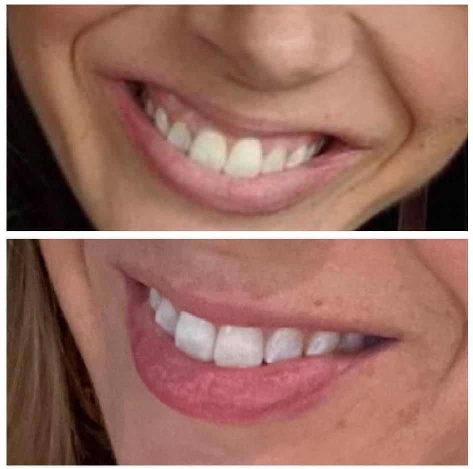 NuSkin AP 24 Whitening Fluoride Toothpaste